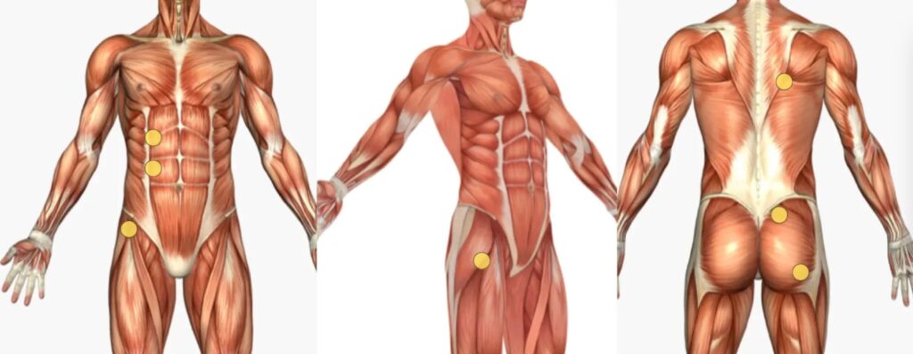 慢性腰痛の筋膜リリース方法