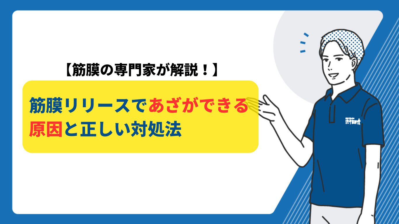 筋膜リリース　あざ