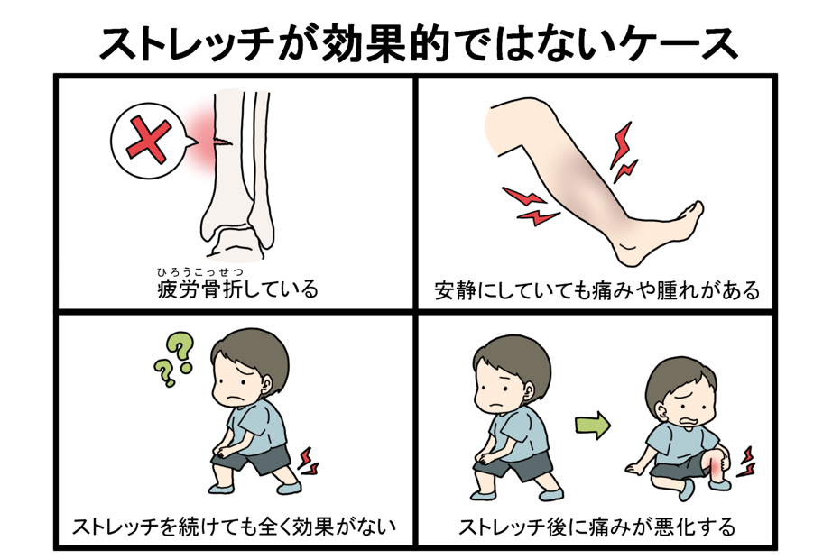 シンスプリント　ストレッチ　