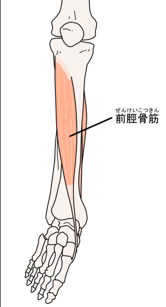 シンスプリント　前脛骨筋