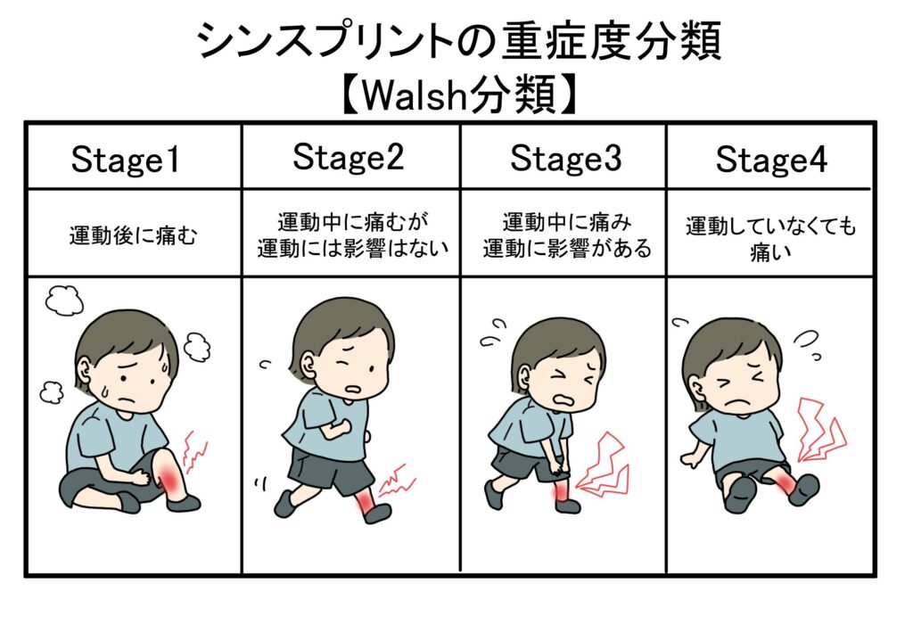 シンスプリント重症度